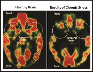 Comparison of two brains